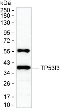 TP53I3